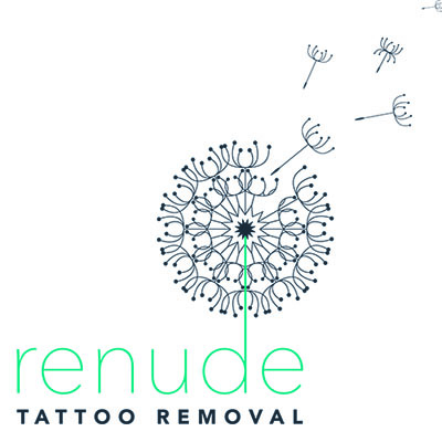 Renude Laser Tattoo Removal