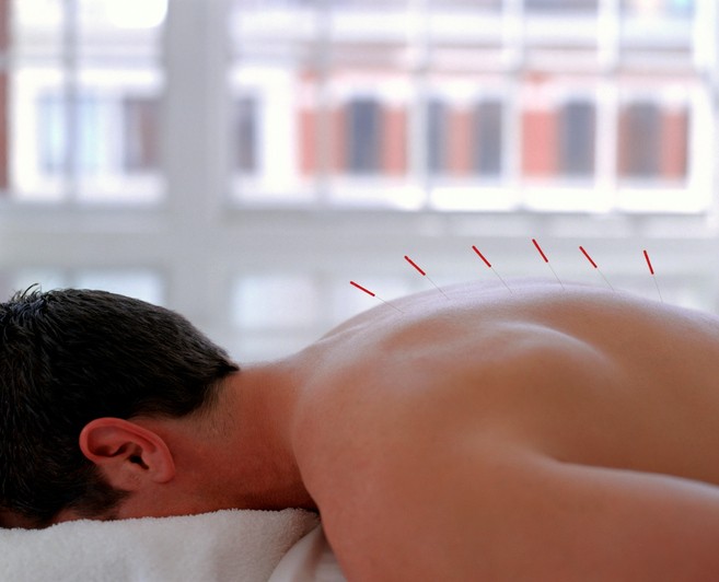 Straight to the Point Acupuncture