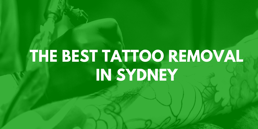 the best tattoo removal sydney banner