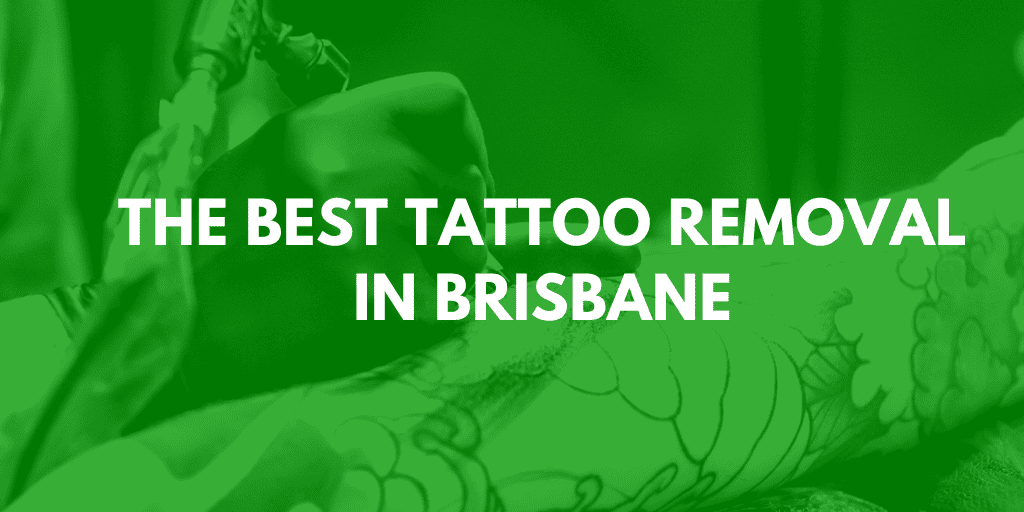 best tattoo removal brisbane