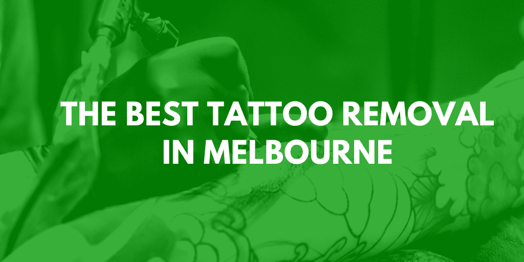 best tattoo removal melbourne banner